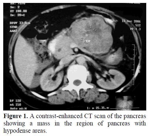 pancreas-a-contrast-enhanced-ct-scan