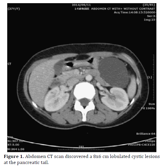 pancreas-abdomen-ct-scan-cystic