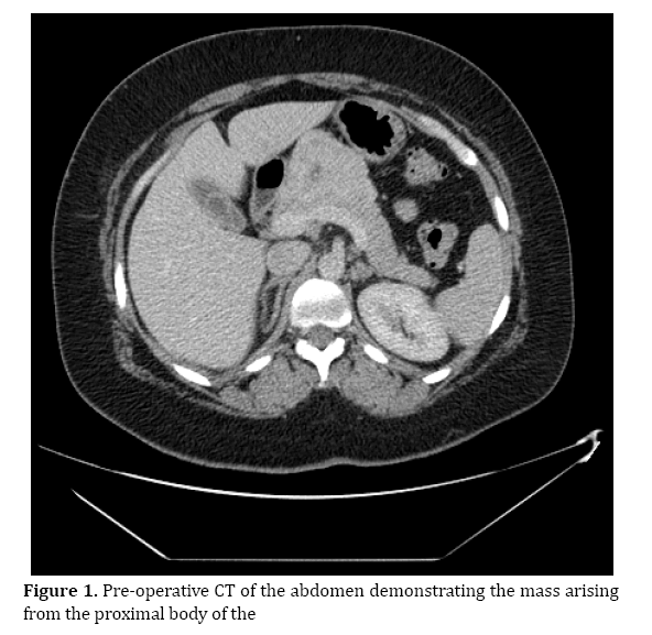 pancreas-abdomen-demonstrating