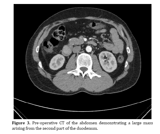 pancreas-abdomen-demonstrating