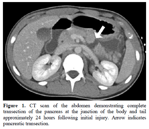 pancreas-abdomen-initial-injury