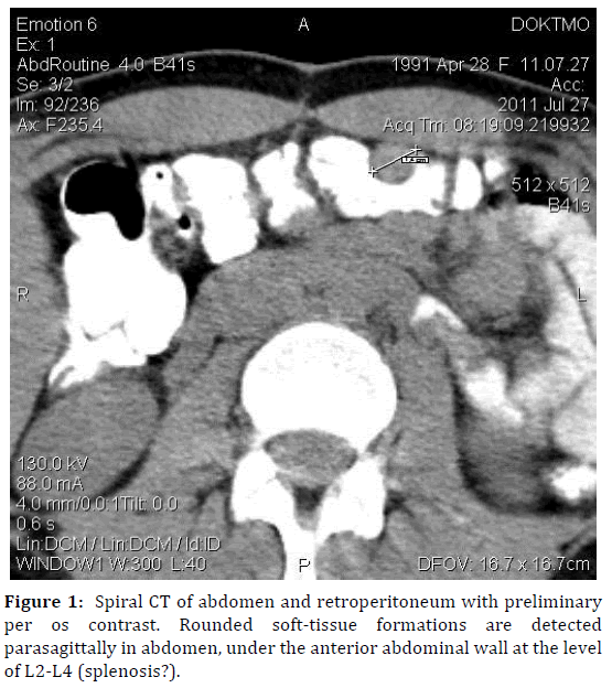 pancreas-abdomen-retroperitoneum-preliminary