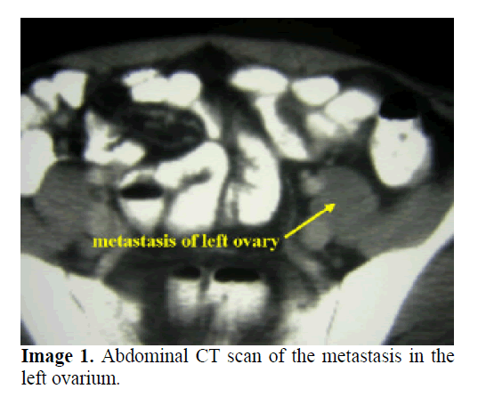 pancreas-abdominal-CT-scan