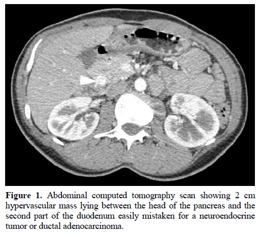 pancreas-abdominal-computed-tomography