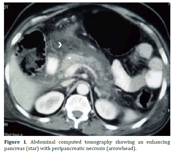 pancreas-abdominal-computed-tomography