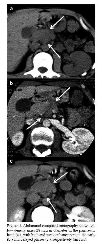 pancreas-abdominal-computed-tomography