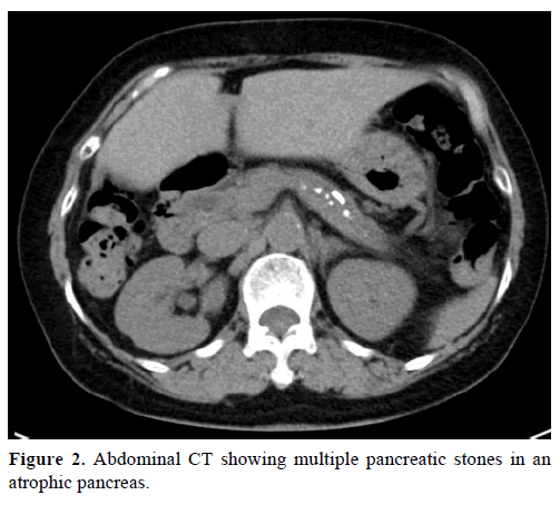 pancreas-abdominal-ct-multiple-pancreatic