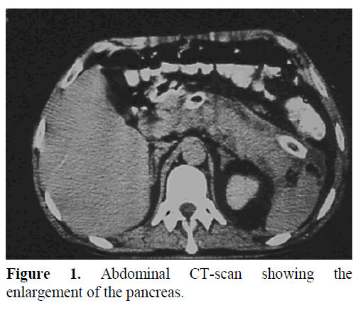 pancreas-abdominal-ct-scan-enlargement