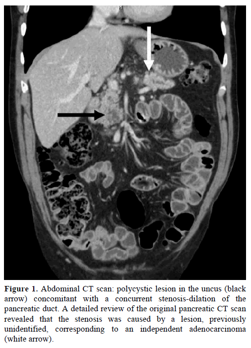 pancreas-abdominal-ct-scan-polycystic