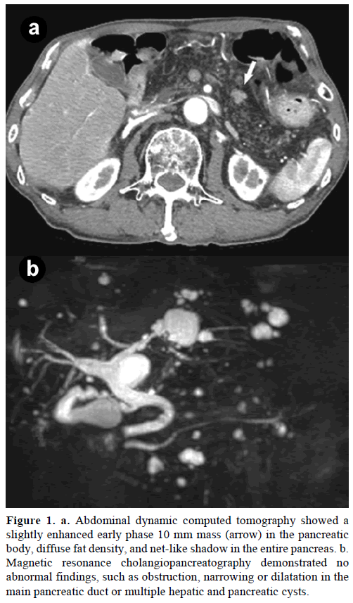 pancreas-abdominal-dynamic-tomography