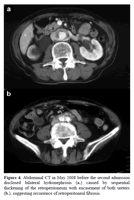 pancreas-abdominal-enhanced-admission