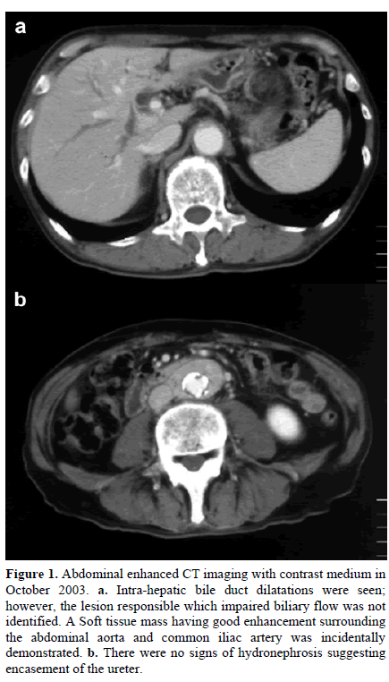 pancreas-abdominal-enhanced-contrast