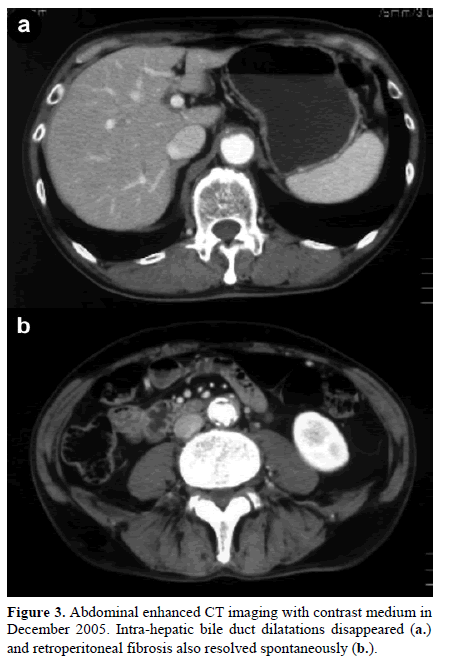 pancreas-abdominal-enhanced-medium