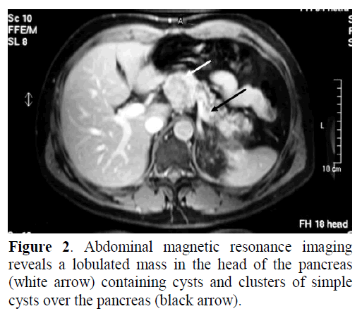 pancreas-abdominal-magnetic-resonance