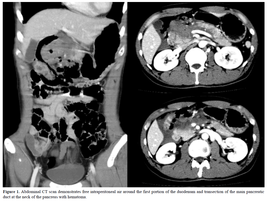 pancreas-abdominal-scan-demonstrates