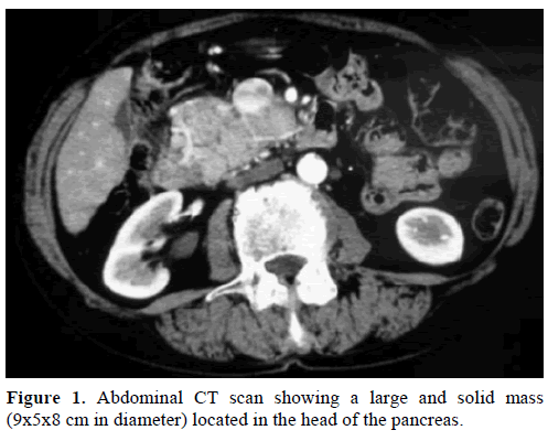 pancreas-abdominal-scan-pancreas