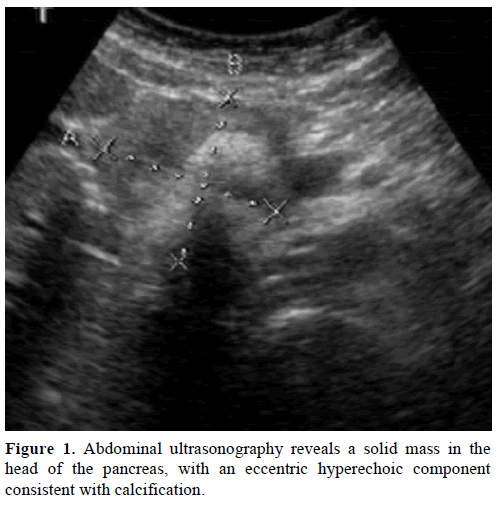 pancreas-abdominal-ultrasonography