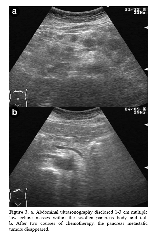 pancreas-abdominal-ultrasonography