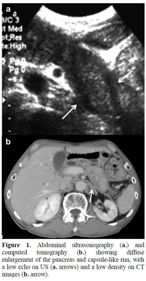 pancreas-abdominal-ultrasonography