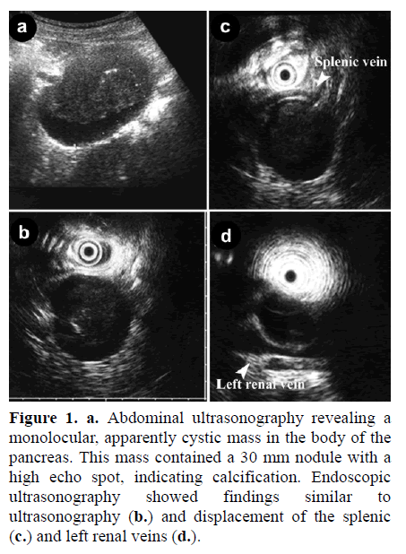 pancreas-abdominal-ultrasonography-revealing