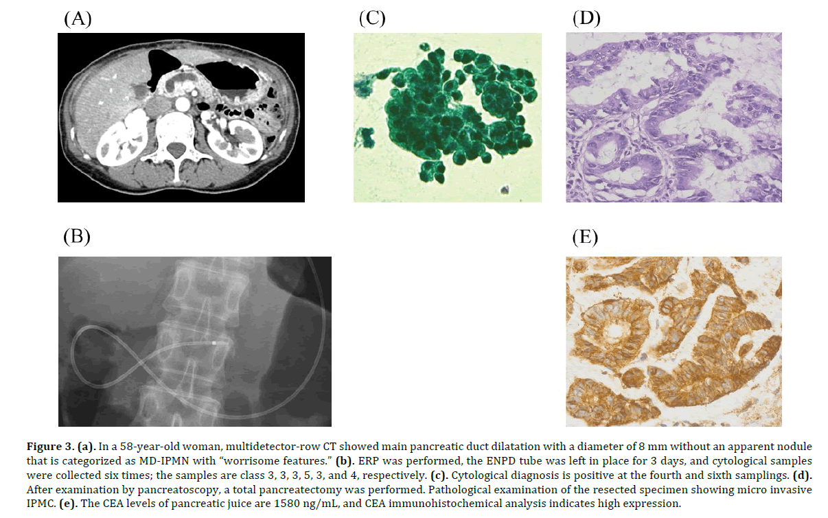 pancreas-according-roc-curves