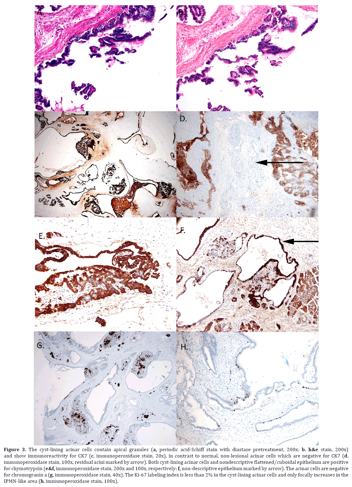 pancreas-acinar-cells-granules