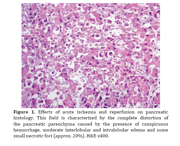 pancreas-acute-ischemia-reperfusion