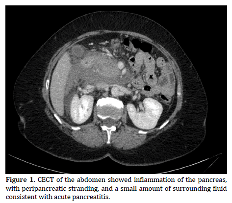 pancreas-acute-pancreatitis