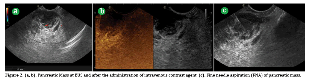 pancreas-administration