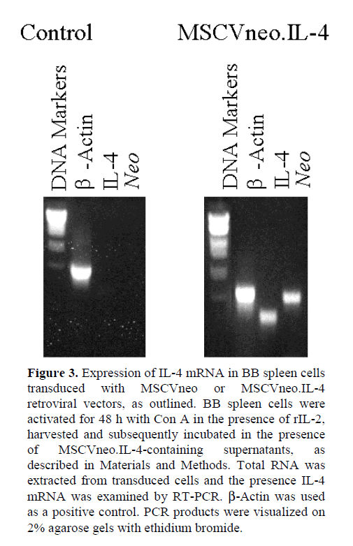 pancreas-agarose-gels-with-ethidium