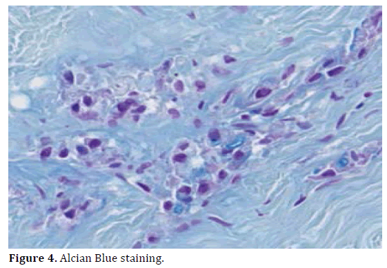 pancreas-alcian-blue-staining