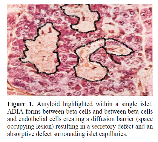 pancreas-amyloid-highlighted-within