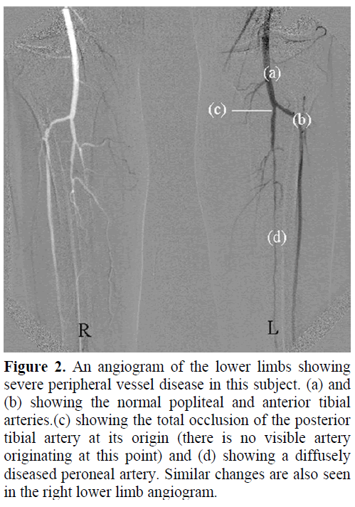pancreas-an-angiogram-lower-limbs-peripheral
