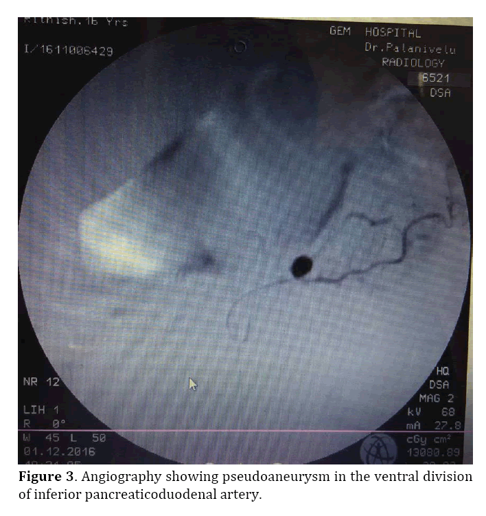 pancreas-angiography