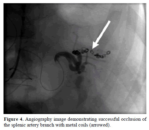pancreas-angiography-demonstratings