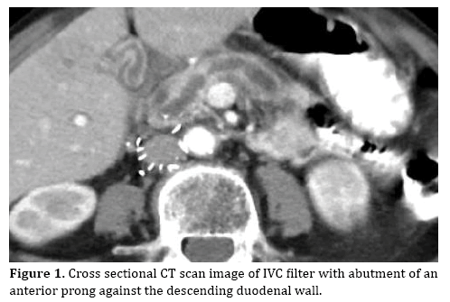 pancreas-anterior