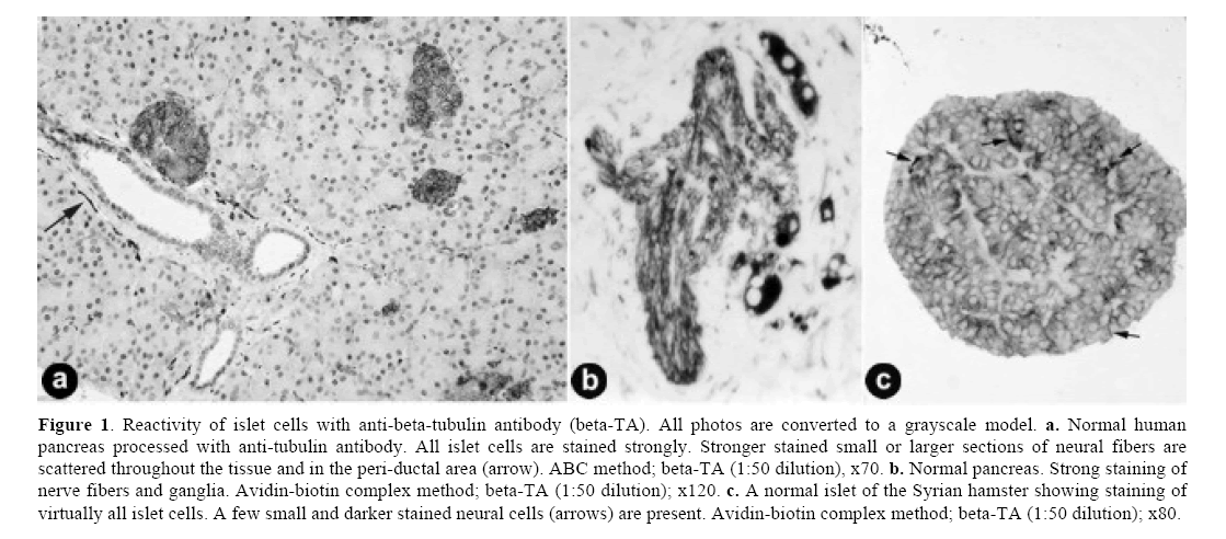 pancreas-anti-beta-tubulin-antibody