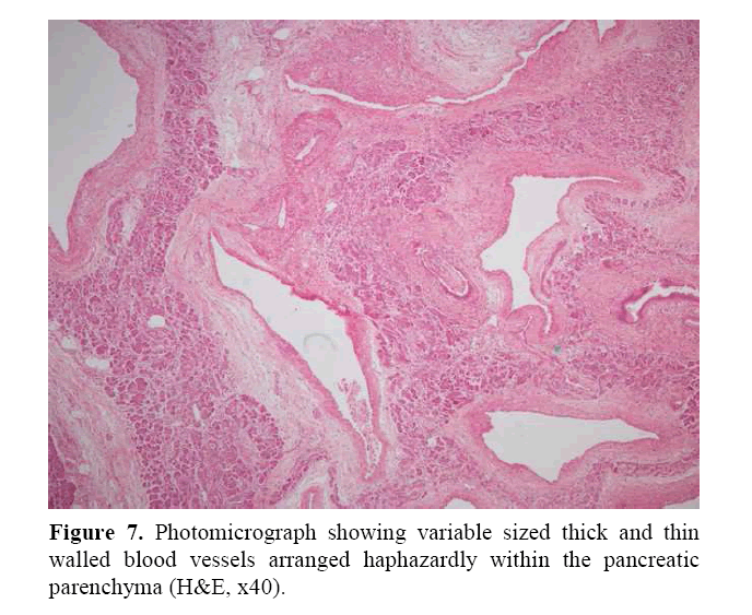 pancreas-arranged-haphazardly-within