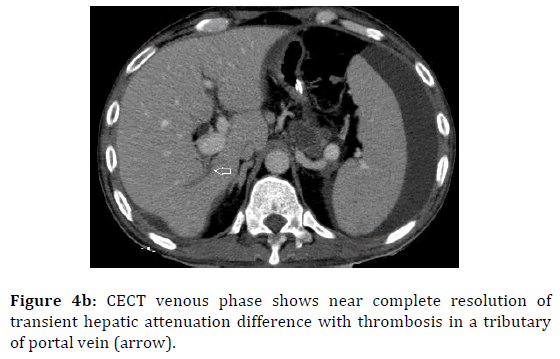 pancreas-arterial-hepatic-attenuation