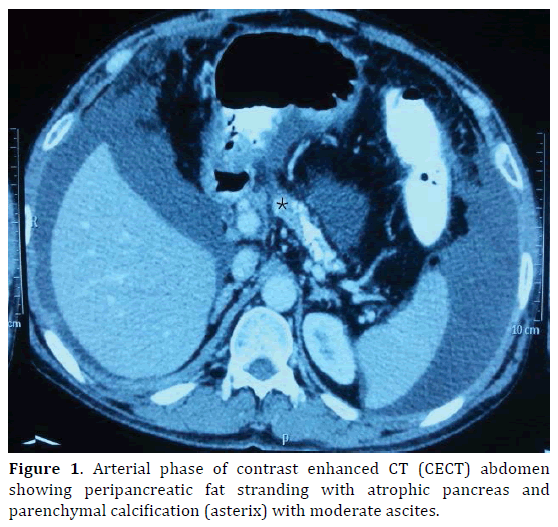 pancreas-arterial-phase-contrast-enhanced