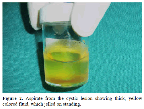 pancreas-aspirate-cystic-lesion-fluid