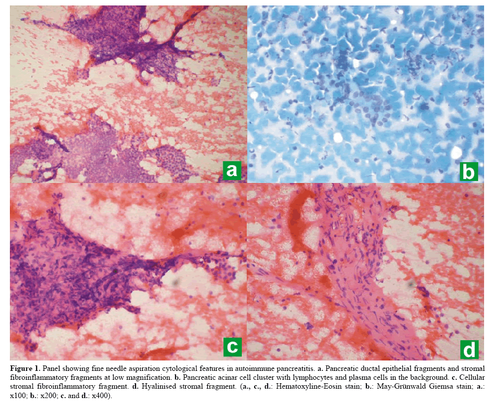 pancreas-aspiration-cytological