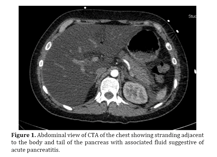 pancreas-associated-fluid-suggestive