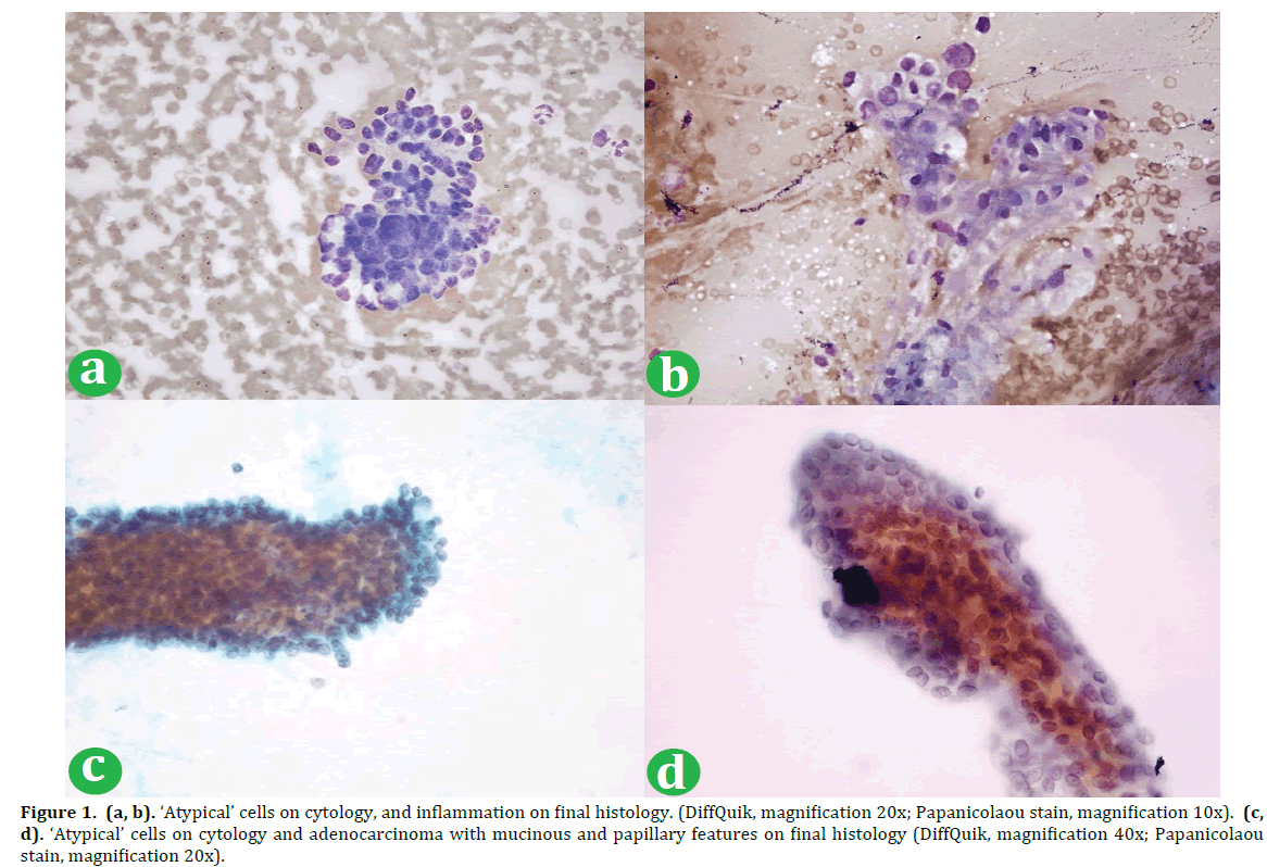 pancreas-atypical-cells-cytology-final