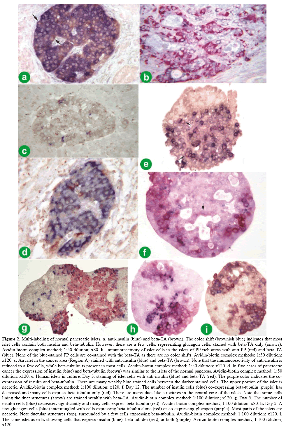 pancreas-avidin-biotin-complex