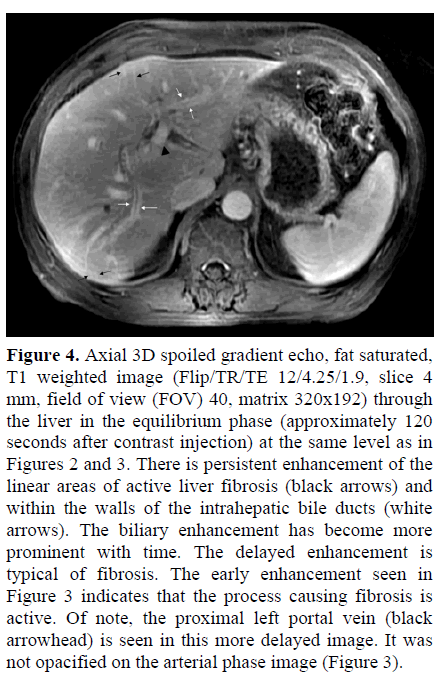 pancreas-axial-3d-gradient-arterial-phase