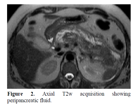 pancreas-axial-T2w-acquisition