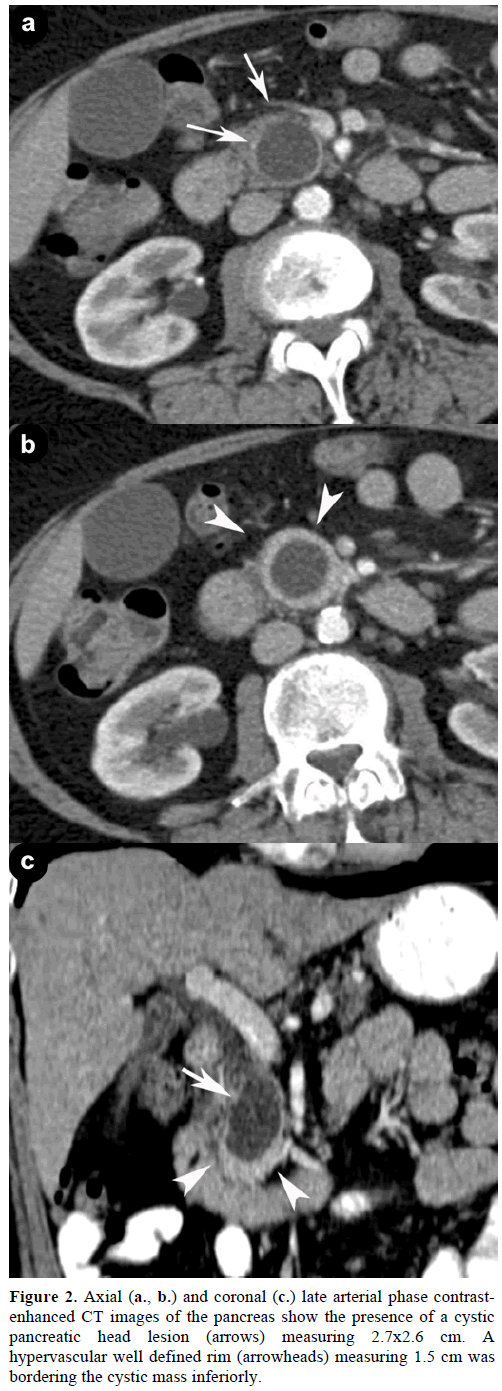 pancreas-axial-coronal-arterial-phase