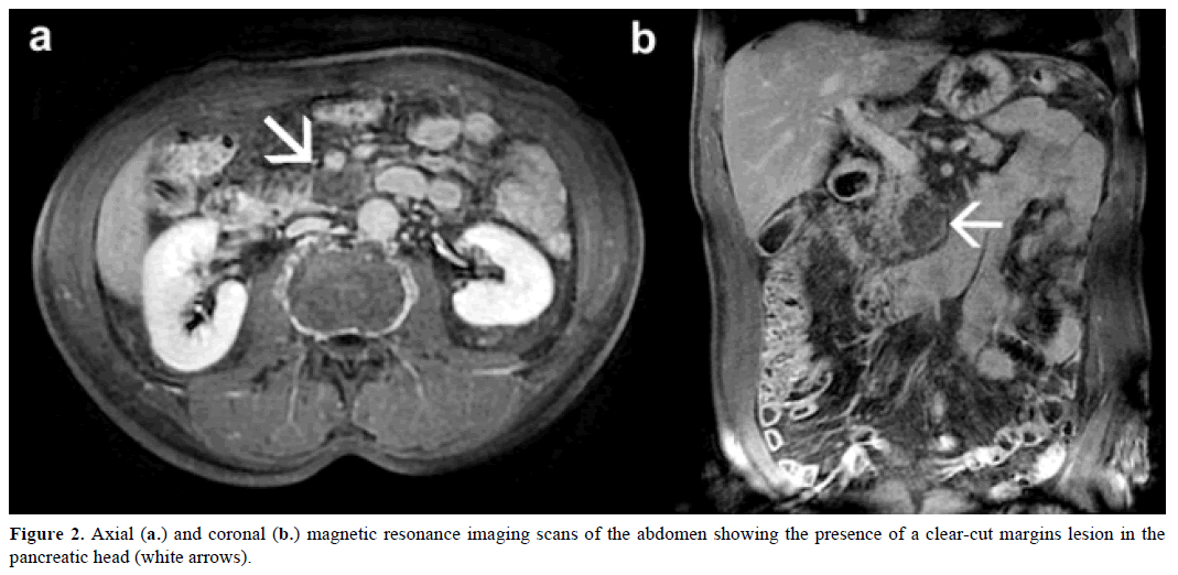 pancreas-axial-coronal-magnetic-resonance