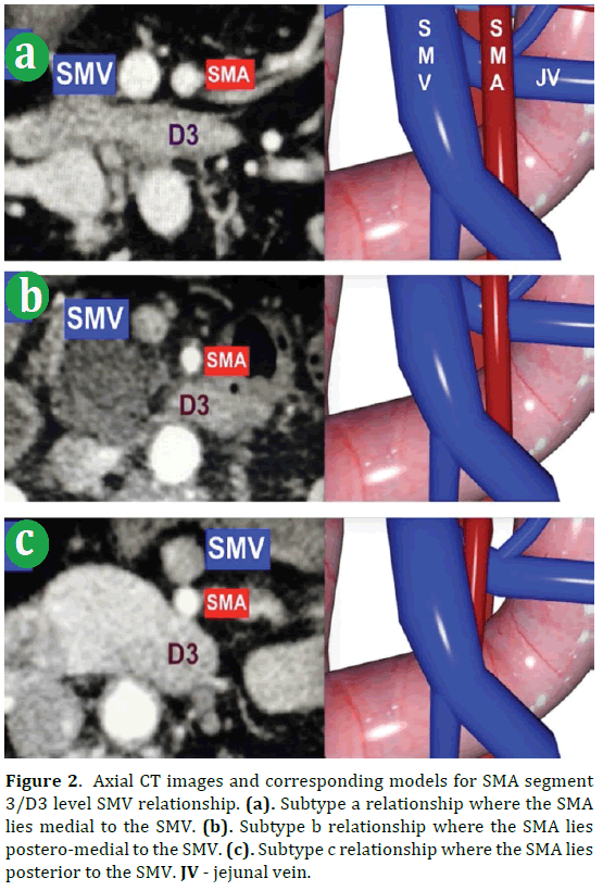 pancreas-axial-ct-images-smv